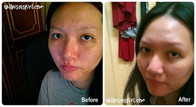 cellnique before after | Facial Review @ Cellnique, Taman Segar