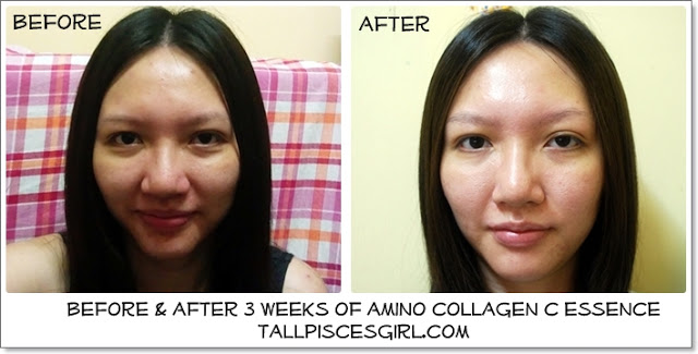 before after collagen | Product Review: Cellnique Amino Collagen C Essence + Giveaway